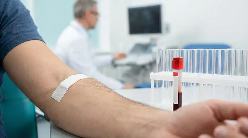 Prostate Cancer Warning Signs: Why PSA Matters